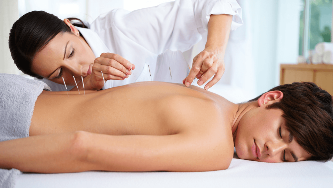 Acupuncture pour maigrir : quels points stimuler ?