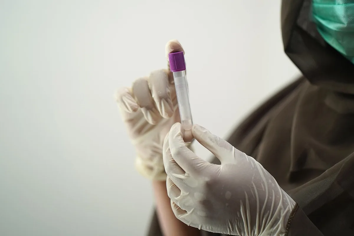 Résultats d'analyse de cholestérol LDL sur un document médical